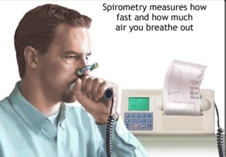 asthma-spirometry