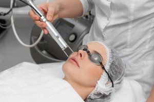 laser-treatment