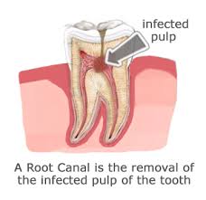 root