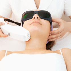 laser treatment